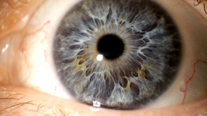 Iris-eigene.jpg