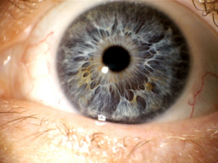 Iris-eigene.jpg